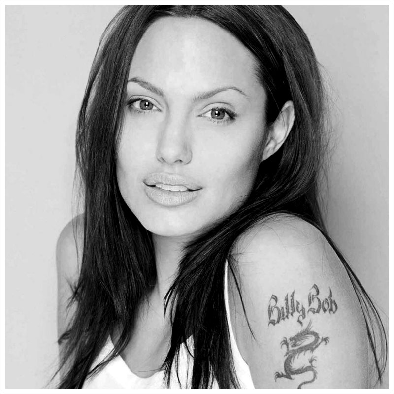 Lazerle Dövme Silme - Nişantaşı Estetik Cerrah